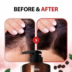 Kundal Natural Caffeine&Intensive Scalp care+ - šampon proti vypadávání vlasů s Kofeinem